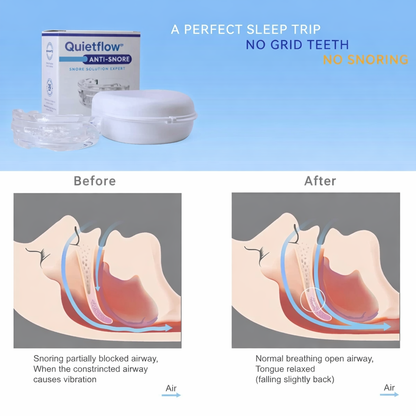 QuietFlow™ Anti Snoring
