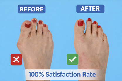 AlignStep™ Bunion Relief