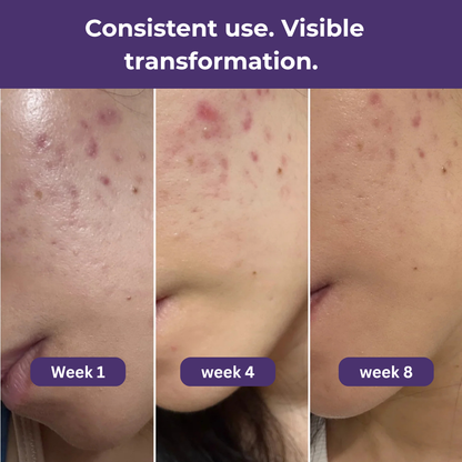 Numbuzin NO.9 NAD+ BIO Skincare Set