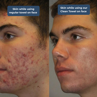 Clean Skin Towels